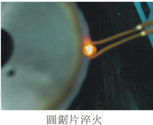 Apparecchiature di fusione a induzione ad altissima frequenza 1-2 MHz